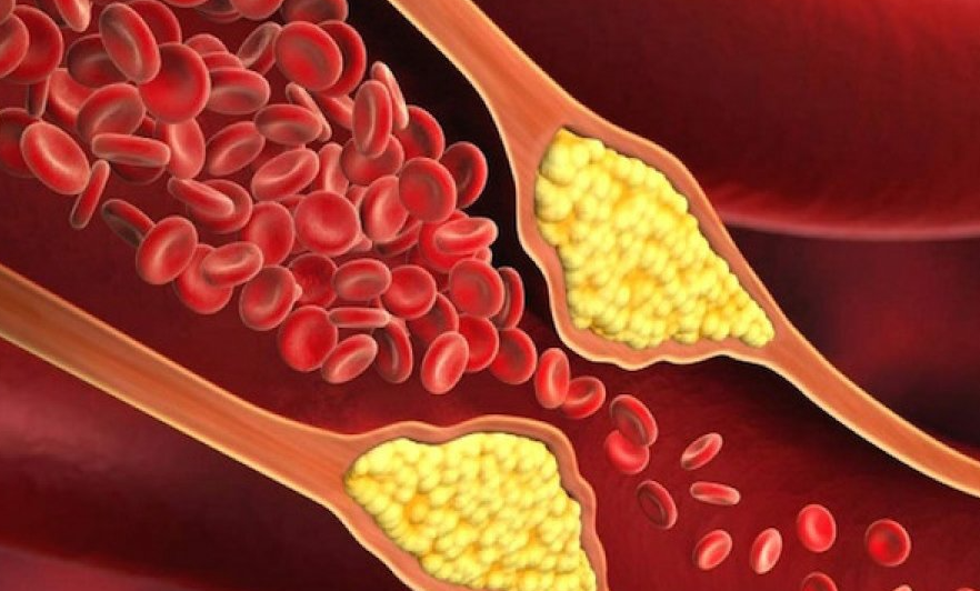 Perceiving the reasons for cardiovascular failures early on