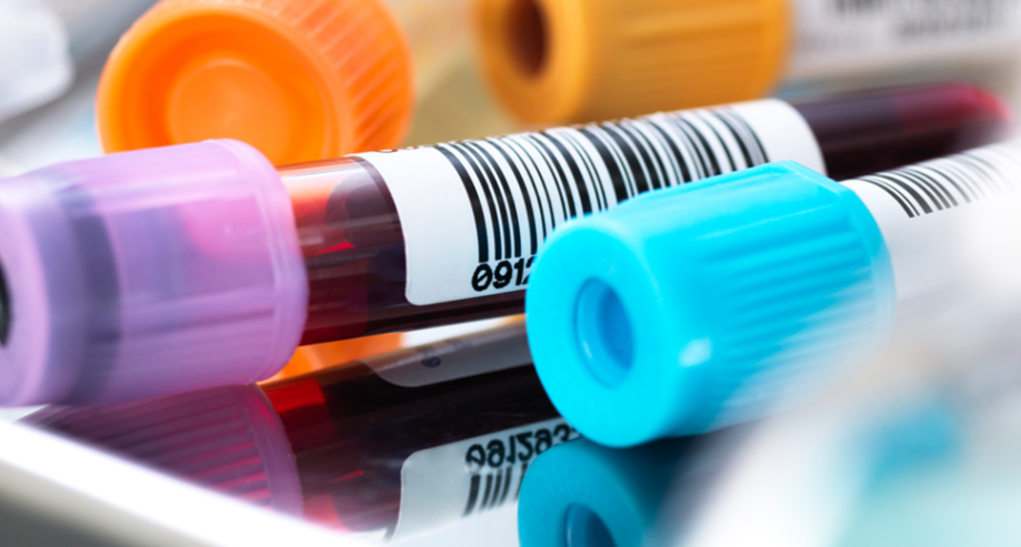 creatinine phosphokinase