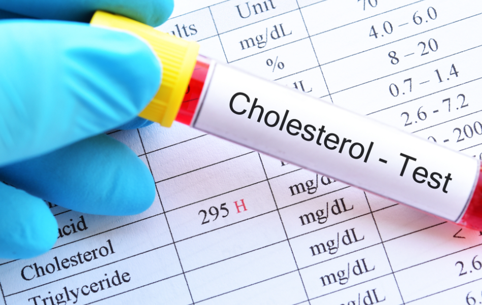 HDL cholesterol testing strategy, otherwise called great cholesterol