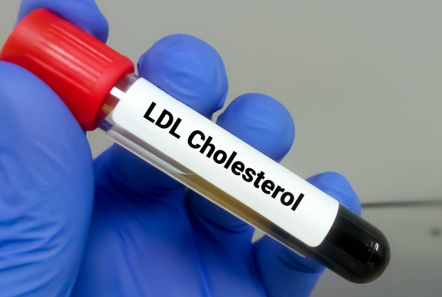 Know the adverse consequences of LDL cholesterol and how to control it