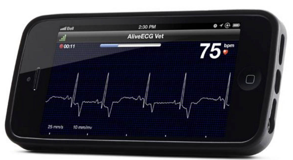 Mobile electrocardiogram